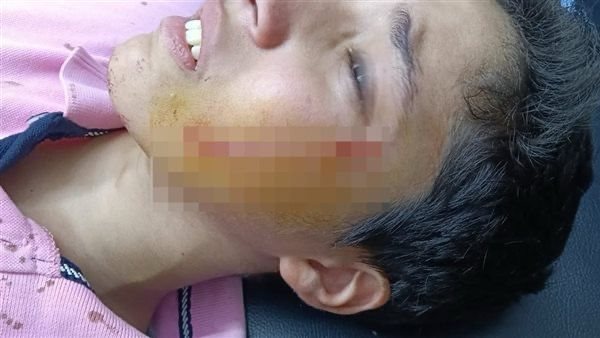 رفض مساعدته في الغش.. إحالة الطالب المتهم بالتعدي على زميله بالبدرشين للمحاكمة الجنائية رفض مساعدته في الغش.. إحالة الطالب المتهم بالتعدي على زميله بالبدرشين للمحاكمة الجنائية