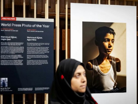 صورة طفل فلسطيني بترت ذراعاه تفوز بجائزة ورلد برس فوتو