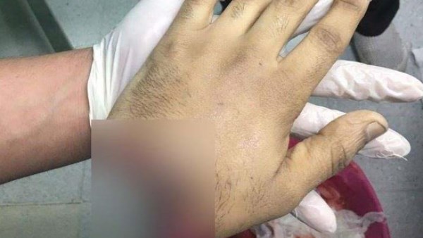 ضحية البلطجة في الهرم : ضربوني وسرقوا التليفون | تفاصيل مأساوية