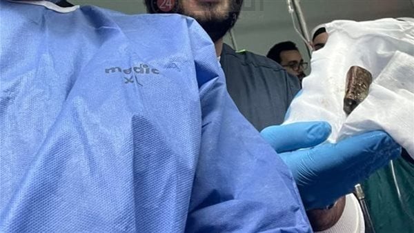 مستشفيات جامعة المنوفية تُجري أول عملية قسطرة مخية بنجاح وتنقذ مريضًا من خطر النزيف الدماغي مستشفيات جامعة المنوفية تُجري أول عملية قسطرة مخية بنجاح وتنقذ مريضًا من خطر النزيف الدماغي