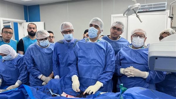 إجراء أول عملية قسطرة مخية بمستشفيات جامعة المنوفية