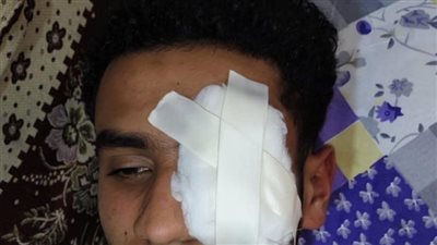 ضبط المتهمين بالتسبب فى فقد عين شاب بالغربية