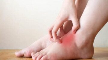 أبرزها تورم القدمين.. حالات تتطلب الحصول على رعاية صحية