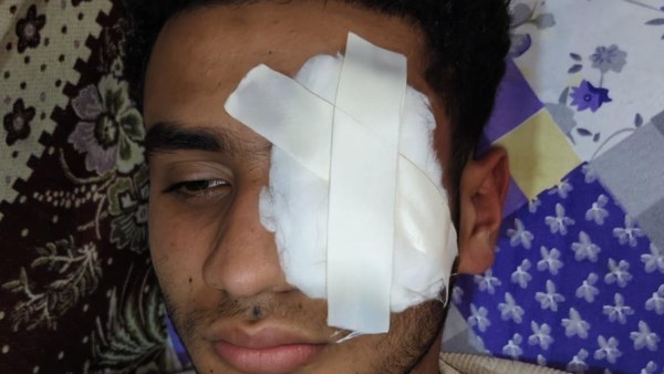لرفضه لعن وطعن السيدات في شرفهن.. الكوارشي يعتدي على شاب ويفقأ عينه بطنطا |القصة الكاملة