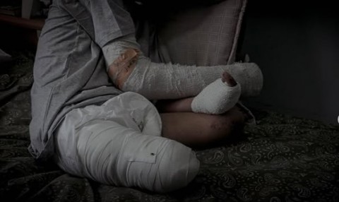 إسرائيل بترت ساقيه.. “الغلبان” فتى الجمباز يحلم بأطراف صناعية
