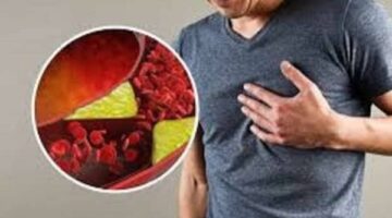 العلاقة بين ارتفاع الكوليسترول وضغط الدم وأثرهما على صحة القلب