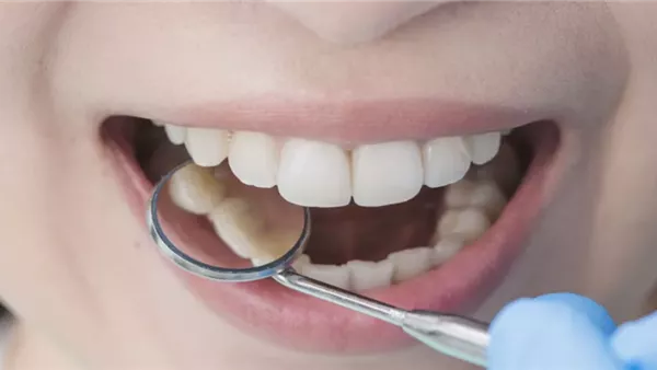 أطباء ينصحون بهذه الأطعمة لتعزيز صحة الأسنان أطباء ينصحون بهذه الأطعمة لتعزيز صحة الأسنان