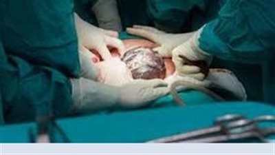 إنقاذ طفل به عيب خلقي بالرئة يبلغ من العمر 3 أشهر في مستشفى قنا