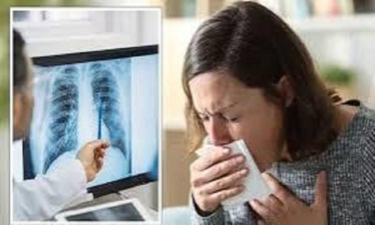 د. أمانى الحنفى: مستشفى الصدر أقدم صرح للعلاج بالمجان