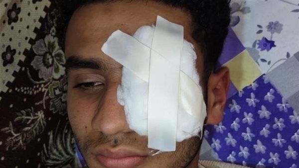 نهاية صادمة لشاب طنطا.. «كلمة دفاع عن الشرف.. كلفته عينه»
