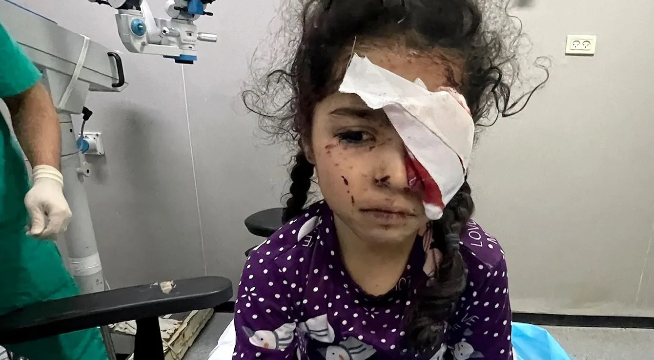 تقرير: 1500 فلسطيني فقدوا البصر بسبب الحرب في غزة تقرير: 1500 فلسطيني فقدوا البصر بسبب الحرب في غزة