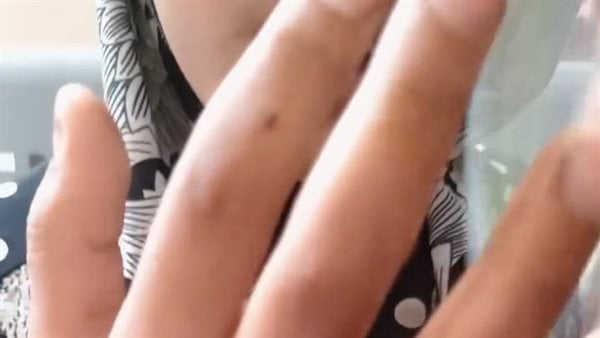 القومي لحقوق الإنسان يتقدم ببلاغ رسمي ضد أب يتهمه بتعذيب ابنتيه في الوادي الجديد