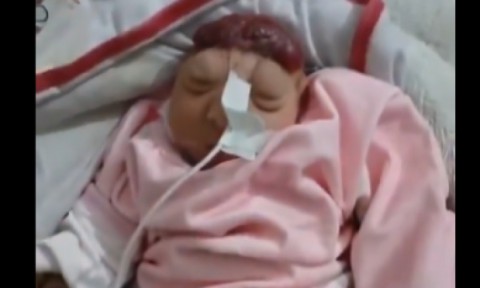 صدمة في غزة.. ولادة طفلة “بلا دماغ” ومطالب بالتحقيق في الأسلحة التي تستخدمها إسرائيل بحرب الإبادة.. (صورة/فيديو)