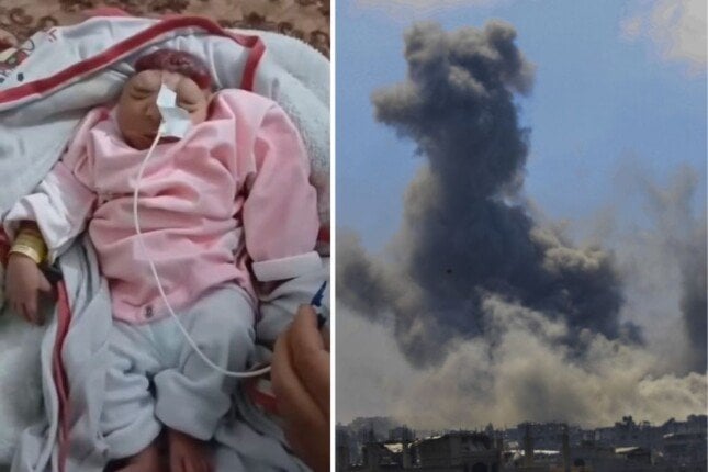 ولادة طفلة بلا دماغ مع تزايد ظاهرة "تشوه الأجنة" في قطاع غزة