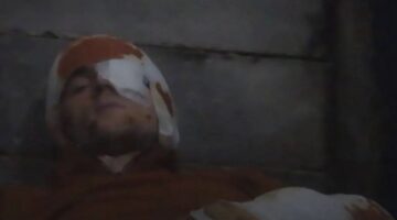 حماس تنشر فيديو يظهر رهينة اسرائيليا جريحا أصيب في قصف إسرائيلي على غزة (فيديو)