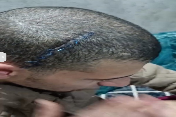 المجني عليه