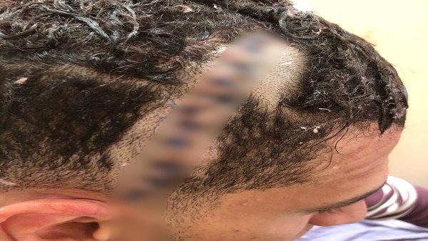 شق رأس حلاق أمام زوجته.. تفاصيل سحل شاب في بني سويف