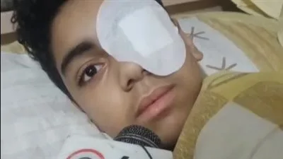 محمد ضحية زميله في الغربية: ضربني بالسيراميكا في عيني عشان رفضت أخليه يلعب كورة معايا