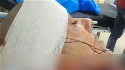 محاولة سرقة تنتهي بجريمة طعن.. إصابة شاب بـ21 غرزة والمتهم ما زال هاربًا ويُهدد المجني عليه