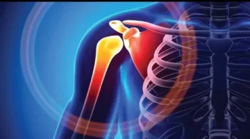 ما هي أسباب كسر عظمة الترقوة؟