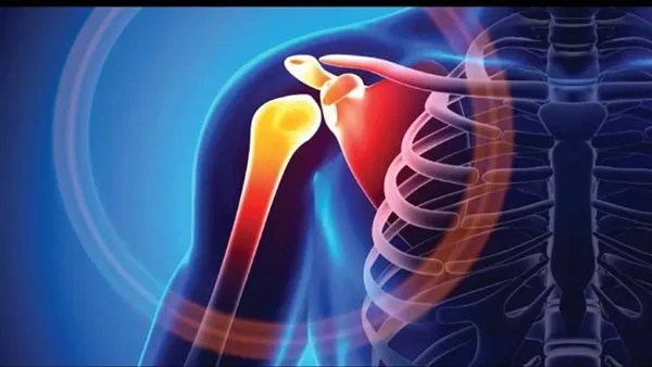 ما هي أسباب كسر عظمة الترقوة؟