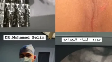 لأول مرة في الدقهلية.. إجراء ناجح لعملية دقيقة لترميم كسر في العنق بتمي الأمديد