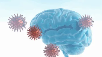 اكتشاف حديث يوضح أسرار كوفيد طويل الأمد