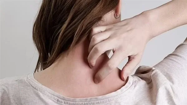علامات غير ظاهرة على الجلد تدل على الإصابة بداء السكري