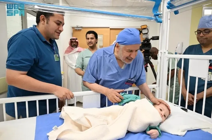 بدء عملية فصل توأم طفيلي مصري بمستشفى الملك عبدالله بالرياض