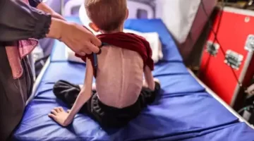 326 حالة وفاة نتيجة نقص الغذاء والدواء خلال 80 يومًا من الحصار في غزة