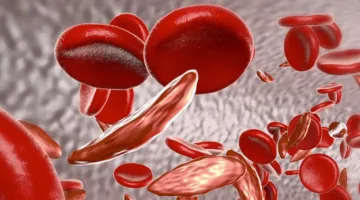 7 أنواع من الأغذية النباتية الغنية بالحديد تعزز مستوى الطاقة والتركيز وتحسن الصحة العامة