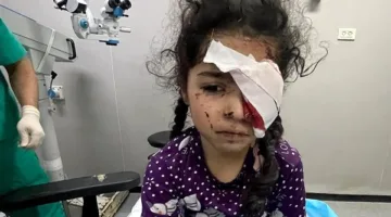 "صحة غزة": 1500 فلسطينى فقدوا البصر و4000 مهددون بفقدانه بسبب الحرب