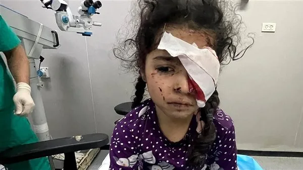 "صحة غزة": 1500 فلسطينى فقدوا البصر و4000 مهددون بفقدانه بسبب الحرب "صحة غزة": 1500 فلسطينى فقدوا البصر و4000 مهددون بفقدانه بسبب الحرب