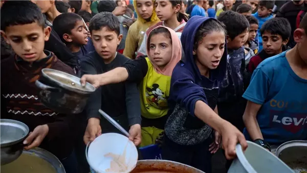 آلاف الأطفال في غزة يعانون سوء التغذية الحاد