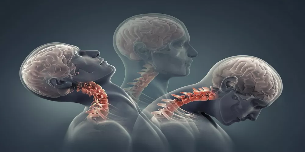 أعراض تنذرك بالإصابة بإرتجاج الدماغ.. انتبه لها