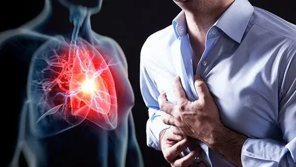 أعراض وعوامل الإصابة بالنوبات القلبية.. احذرها