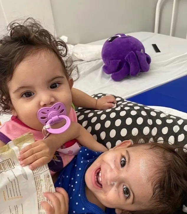 إجراء جراحي لمدة 15 ساعة لفصل توأمين ملتصقين من منطقة الصدر والبطن