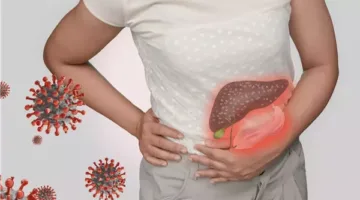 احترس من هذه الدلالات قبل تفاقم الوضع.. علامات تليف الكبد