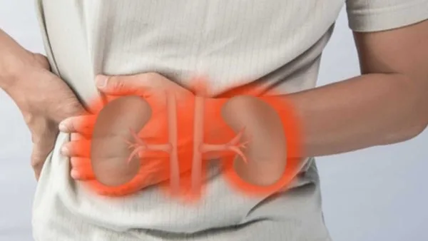 احذرها.. 3 أطعمة يجب تجنبها للحفاظ على صحة الكلى
