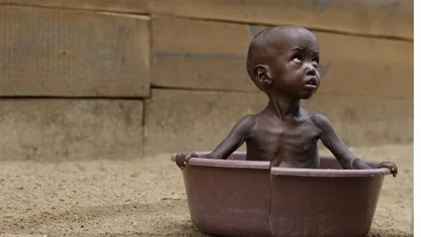 اشتباكات جنوب السودان تحرم أكثر من 60 ألف طفل من المساعدات الغذائية