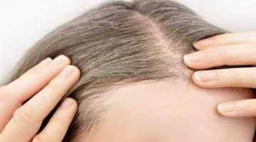 الشيب المبكر في مرحلة الشباب: 6 أسباب خفية وراء ظهور الشعر الأبيض في وقت مبكر