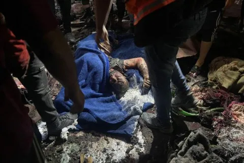 اليوم الـ 595: الجيش الإسرائيلي يستمر في هجومه على قطاع غزة وارتفاع عدد الشهداء وزيادة في انتشار المجاعة. اليوم الـ 595: الجيش الإسرائيلي يستمر في هجومه على قطاع غزة وارتفاع عدد الشهداء وزيادة في انتشار المجاعة.