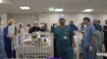 بالفيديو.. تابعوا لحظة خروج التوأم الإريتري أسماء وسمية من غرفة العمليات بعد نجاح فصلهم.