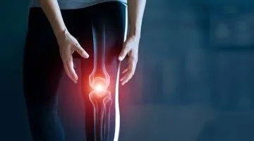 بالفيديو.. خبير يوضح هل يمكن للكولاجين أن يعالج خشونة الركبة؟