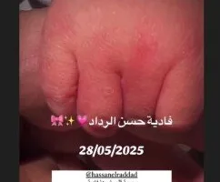 حسن الرداد وإيمي سمير غانم يعودان إلى الواجهة مجددًا | التفاصيل