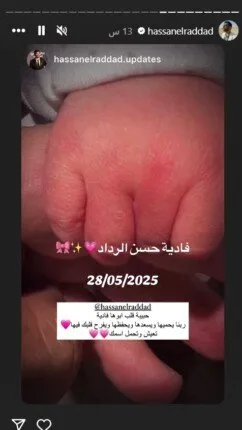 حسن الرداد وإيمي سمير غانم يعودان إلى الواجهة مجددًا | التفاصيل