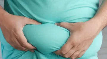 رابط غير متوقع بين دهون البطن ومرض الصدفية المزمن