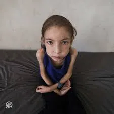 رهف عياد.. طفلة تنهشها الإبادة في غزة وسط عجز طبي وحصار خانق