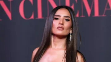 «زينة» تروي تفاصيل تعرض طفليها لهجوم كلب شرس