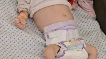 «سلاح التجويع» أهالي غزة يدخلون المرحلة الخامسة.. و«الأسبوع» توثق قتل البراءة في القطاع